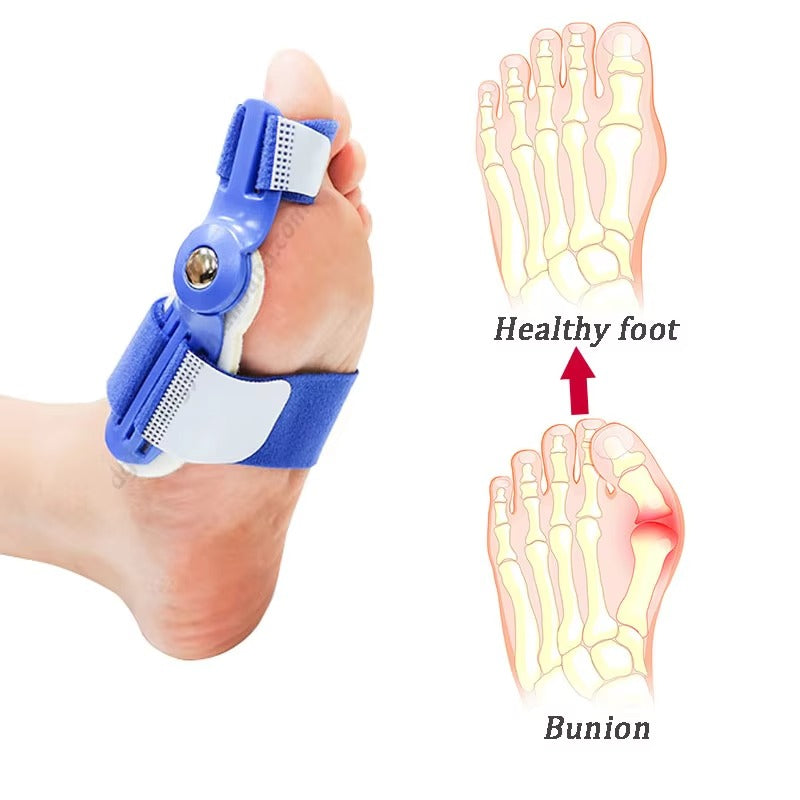 Adjustable Bunion Corrector Knob Big Toe